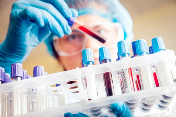 ¿Qué es el chequeo general de sangre?